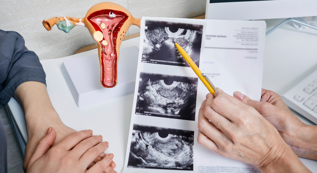 Effective Polycystic Ovary Syndrome (PCOS) in Faridabad | Holistic Care
