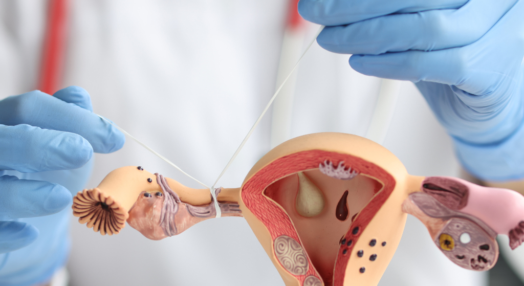 Tubal blockage treatment in Faridabad 